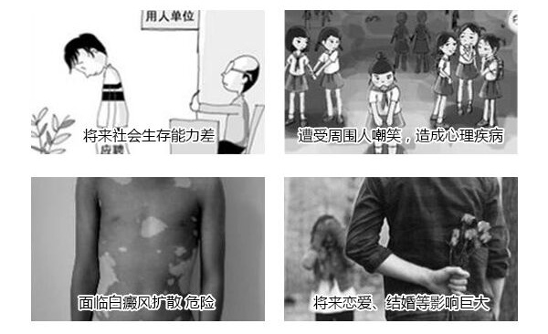 【公益】9月 ▏开学季·祛白变形计