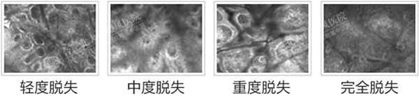 【公益】9月 ▏开学季·祛白变形计