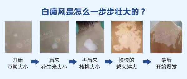 【公益】8.26—27日北京三甲专家邹凌云亲诊北大