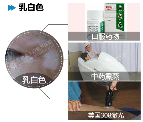 六安女性如何防范白癜风