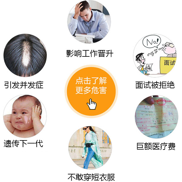 合肥白癜风布满全身有什么危害