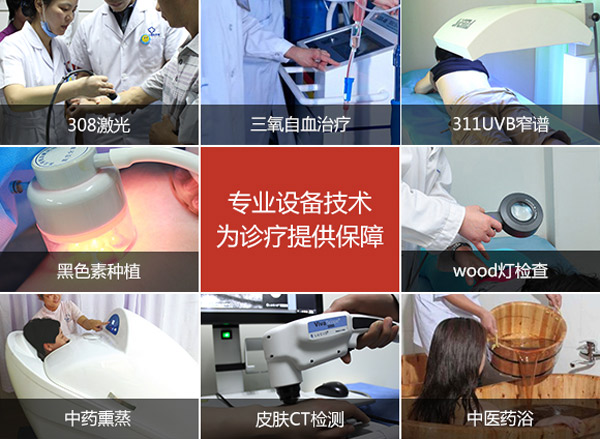 白癜风不扩散还需要治疗吗