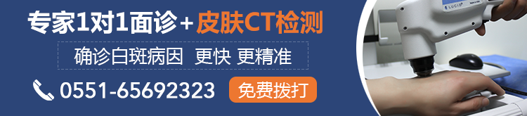 白癜风患者在治疗过程中应注意什么