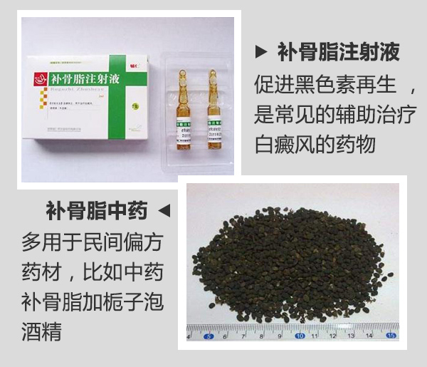药物会引发白癜风吗?