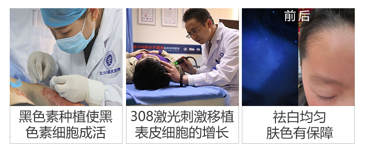 合肥如何避免白癜风复发