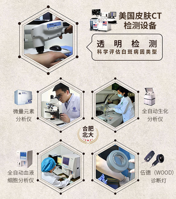 白癜风稳定期适合什么治疗？