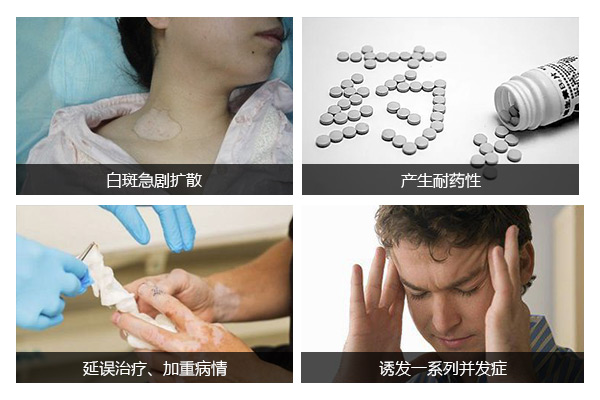 颈部白癜风的治疗需要注意什么呢