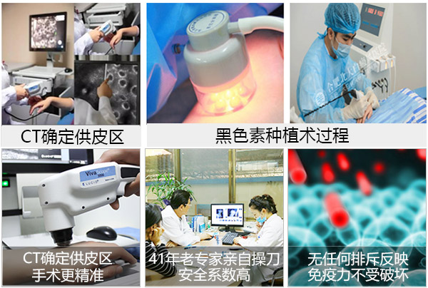 合肥白斑患者如何避免辐射