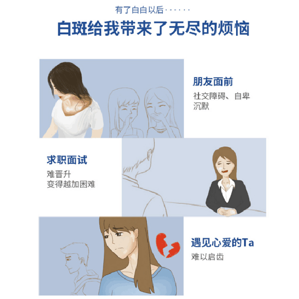 上海白癜风给女性患者带来哪些影响