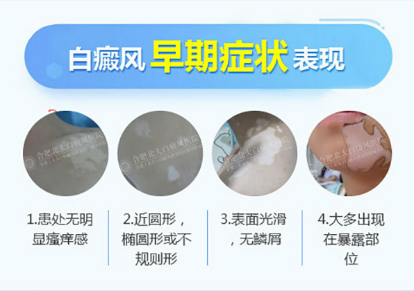 6月22-23日南京皮研所沈建平介绍白癜风早期