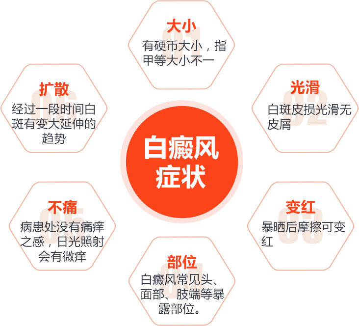 上海有几个白癜风专科医院,白癜风发生后的症状有哪些呢