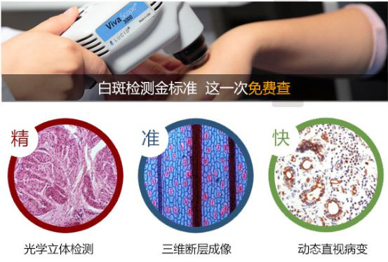 合肥节段性白癜风的病因是什么呢