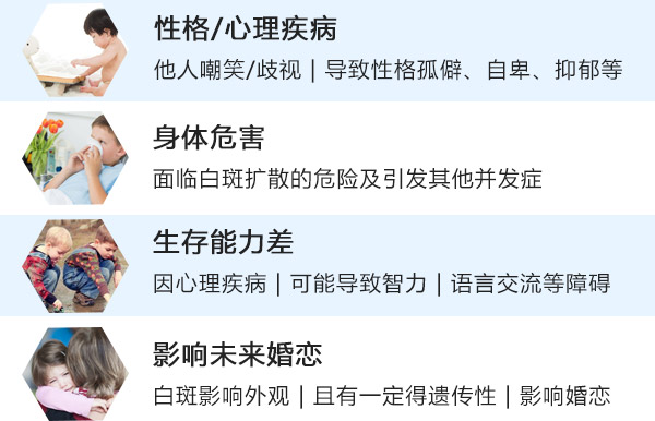 白癜风会给女性患者带来的危害是什么?
