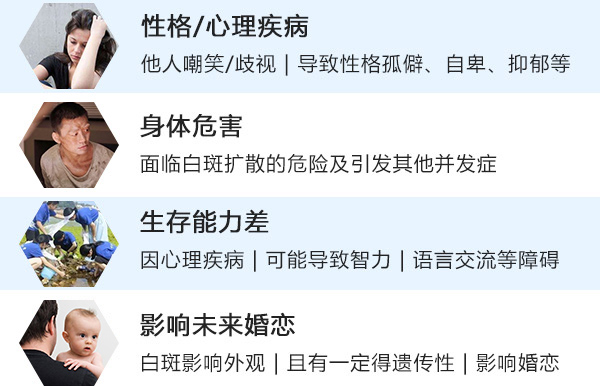 宣城创伤性白癫风有哪些危害