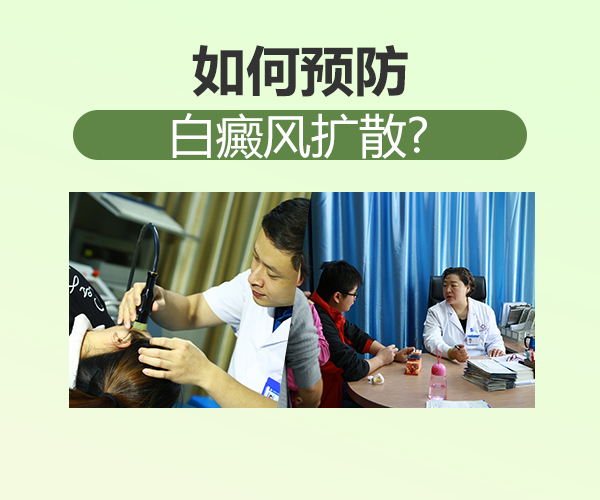 上海去哪家白癜风医院好,白癜风患者怎样防止身上的白斑扩散