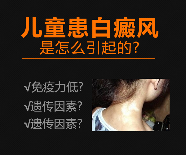 上海健桥医院：孩子为什么会患上白癜风