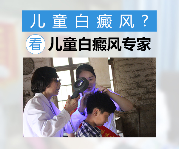 合肥孩子面部白癜风什么原因造成的