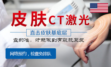 合肥激光医治白癜风的优势