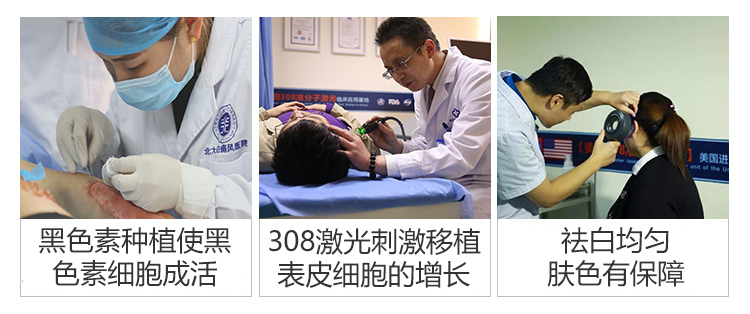 患上白癜风如何正确治疗?