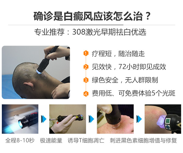 上海治疗白癜风皮肤病医院，已经确诊为白癜风