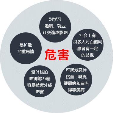 白癜风的影响有哪些?