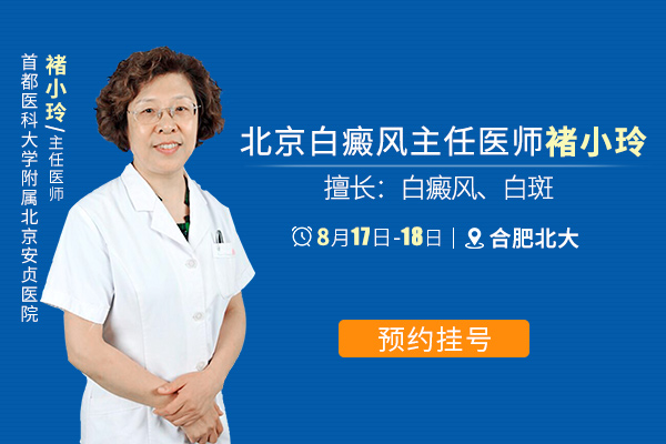 北京白癜风医师莅临指导 暨暑期白斑确诊普查