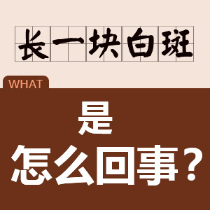 白癜风的病因有哪些？