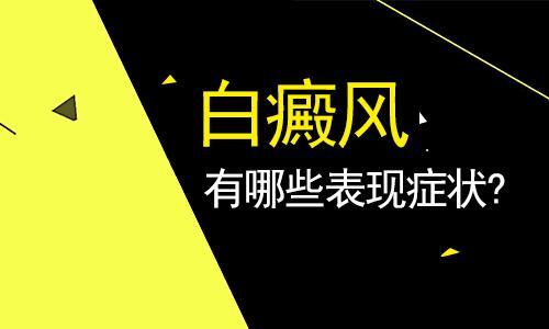 绍兴市哪家医院治白癜风 阶段性白癜风有什么症状