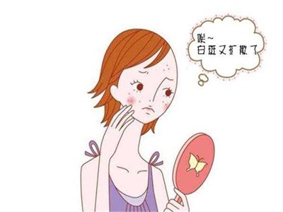 合肥白癜风哪家好,可以治疗面部白斑吗