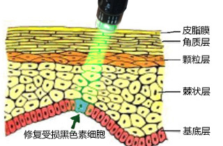 秋季怎么预防牛皮癣疾病