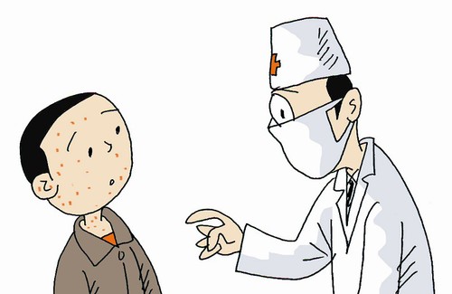上海医院答白癜风脱皮是怎么回事？