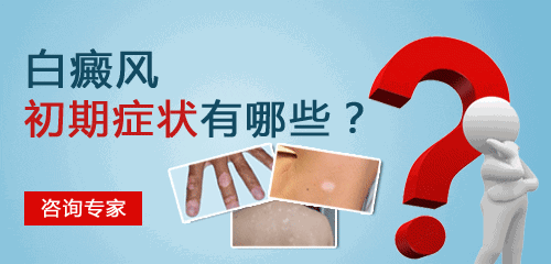 海口看白癜风医院 白癜风初期症状有哪些