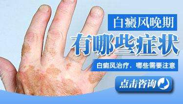 6月8日—9日南京皮研所候伟专家会诊白癜风手臂