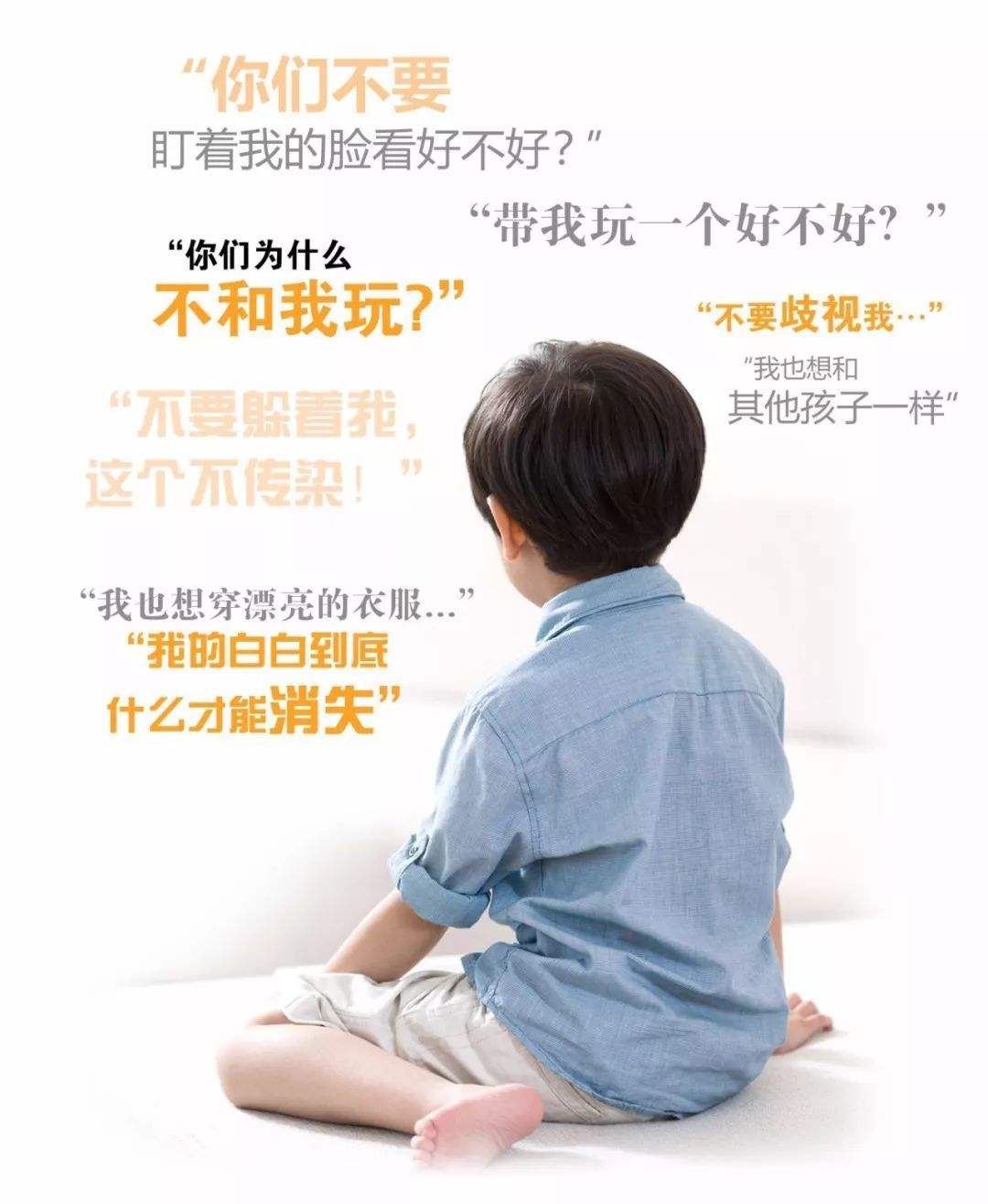 上海白癜风对儿童的危害有多大呢