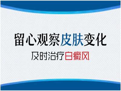 阜阳如何治疗肩部白癜风不会扩散?