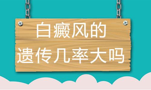 白癜风的遗传几率大吗