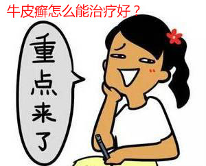 皮肤上有牛皮癣该怎样治