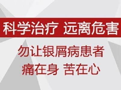 亳州治疗银屑病如何快速止痒?