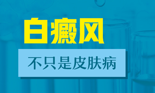 腿部白癜风可以不治疗吗?