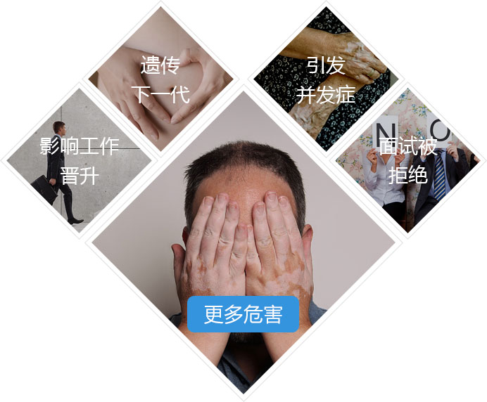 上海白癜风疾病会给老年人带来哪些危害?